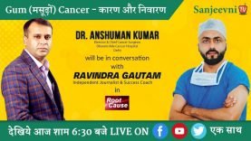 Gum (मसूढ़ों) का Cancer – कारण, लक्षण व निवारण